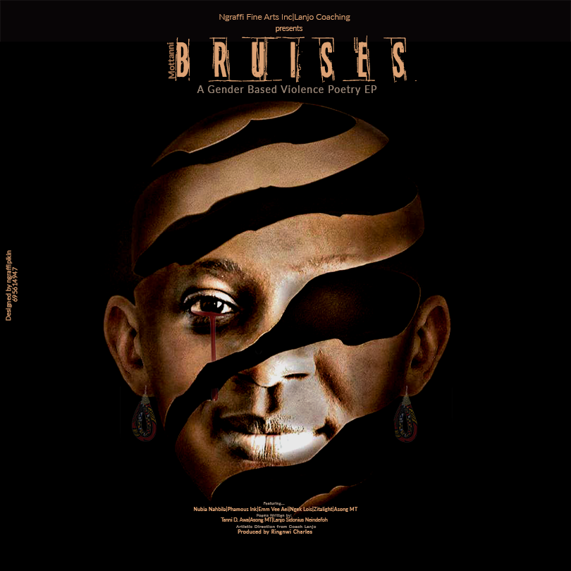 Bruises I: The Genesis